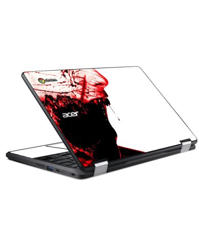 Acer  Chromebook R751TN-C5P3 BITE MARKS Laptop Skin